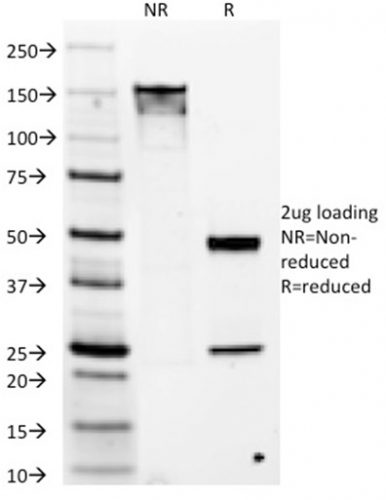 Data from SDS-PAGE analysis of Anti-DOG1 antibody (Clone DG1/1486). Reducing lane (R) shows heavy and light chain fragments. NR lane shows intact antibody with expected MW of approximately 150 kDa. The data are consistent with a high purity, intact mAb.